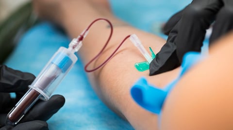 Cancers can be detected in bloodstream three years prior to diagnosis