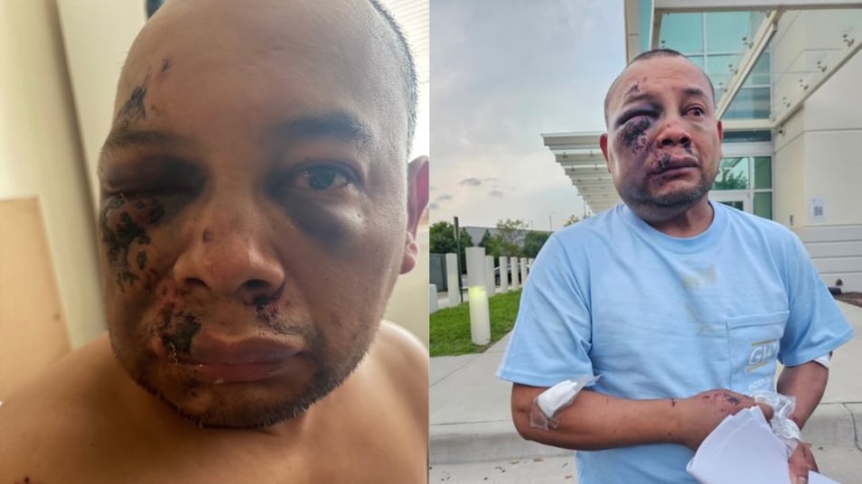 Lawyer Says ICE Detainee Suffered Brain Bleed After Violent Apprehension, Was Guarded by Agents Instead of Given Private Medical Care