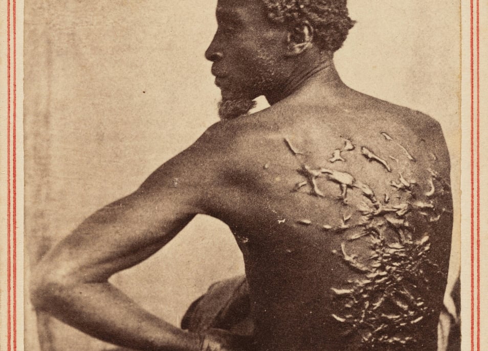 National park to remove photo of enslaved man’s scars